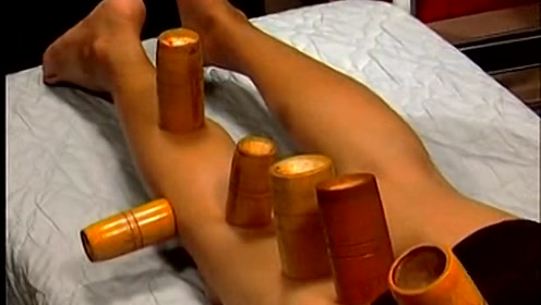 cupping therapy on foot