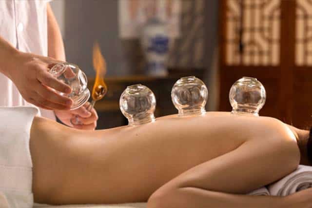 Cupping therapy, everything you need to know