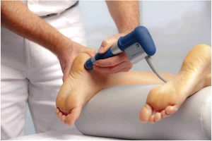 shockwave therapy treats plantar fasciitis