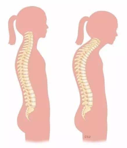 standing with flat back posture