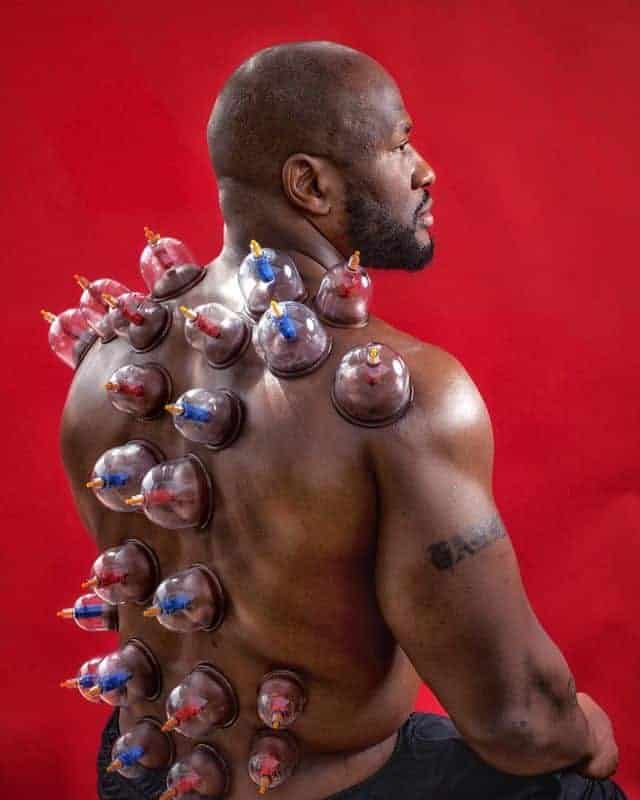 NFL player tries cupping