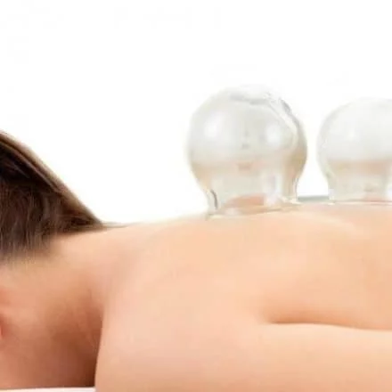 cupping therapy in pickering and milton