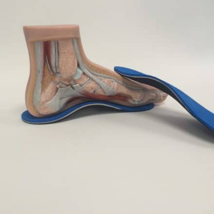 Custom Foot Orthotics Pickering 