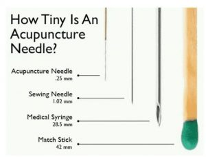 acupuncture needle size chart