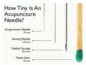 acupuncture needle size chart