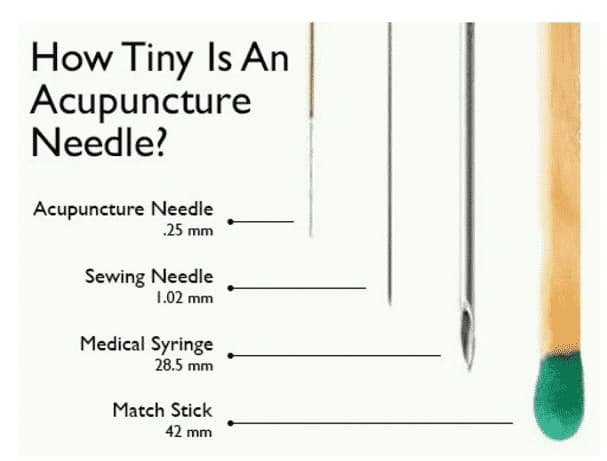 acupuncture needle comparison