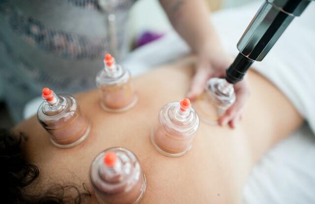 Cupping Therapy Benefits