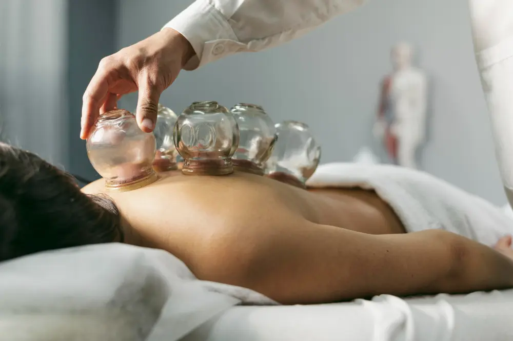cupping therapy